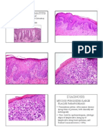 2008 04 Lecture 2 Psoriasiform Dermatitis Cassarino