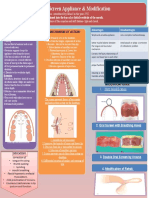 Mechanism of Action: Fabrication:: Oral Screen Appliance & Modification