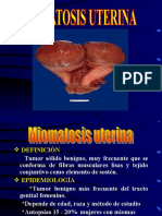 Fibromatosis Uterina