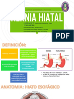 Hernia Hiatal