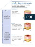 Etapas de Ulceras
