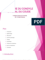 Fracture Du Condyle Lateral Du Coude PDF