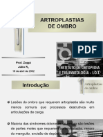 Artroplastia Glenohumeral