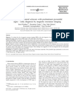 Amyotrophic Lateral Sclerosis With Predominant Pyramidal - 2006 - Magnetic Reso