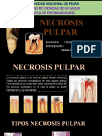 Necrosis Pulpar