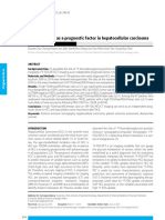 F-FDG PET CT As A Prognostic Factor in Hepatocellular Carcinoma