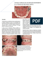 Rehabilitación Adhesiva de Boca Completa de Una Dentición Severamente Erosionada: La Técnica de Tres Pasos.