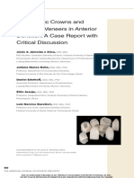 Almeida. All-Ceramic Crowns and Extended Veneers in Anterior Dentition PDF