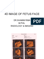 4D Mage of Fetus Face