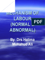 MECHANISM OF LABOUR (NORMAL and ABNORMAL)