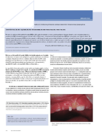 Defectos de Desarrollo Atípicos Del Esmalte en Incisivos Primarios Versus Resorción Intracoronal Preeruptiva (PEIR) : Informes de Casos