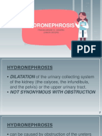 Hydronephrosis: Trisha Denise D. Cedeño Junior Intern