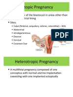 Ectopic Pregnancy