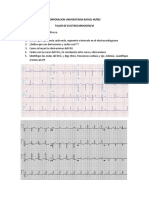 Taller Ekg - Emily Guevara