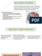 Teratoma Ovárico Inmaduro