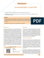 Neonatal Neurosonography: A Pictorial Essay: Euroradiology