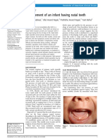 Management of An Infant Having Natal Teeth: Vishal Khandelwal, Ullal Anand Nayak, Prathibha Anand Nayak, Yash Bafna