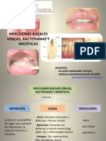 Infecciones Bucales Víricas, Bacterianas y Micóticas.