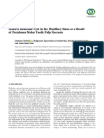 Case Report Massive Radicular Cyst in The Maxillary Sinus As A Result of Deciduous Molar Tooth Pulp Necrosis