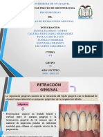 Tecnica de Retraccion Gingival