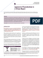 Endodontic Management of Taurodontism in Maxillary Molar: A Case Report