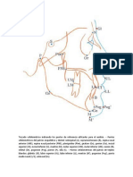 Trazado Cefalométrico Indicando Los Puntos de Referencia