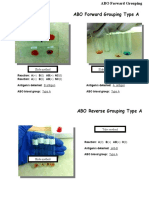 ABO Grouping BB Lab