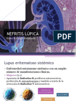 Nefritis Lupica 170319034631