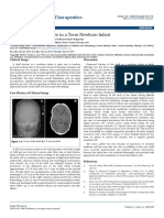 Depressed Skull Fracture in A Term Newborn Infant 2161 0665 1000i109