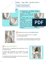 Identificacion de Zonas Protésicas