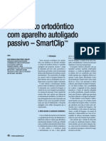 Tratamento Ortodôntico Com Aparelho Autoligado Passivo - Smartclip