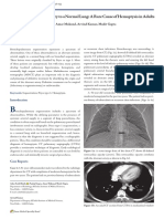 OMJ Anomalous Systemic Artery To A Normal Lung - A Rare Cause of Hemoptysis in Adults