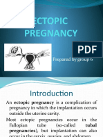 Ectopic Pregnancy: Prepared by Group 6