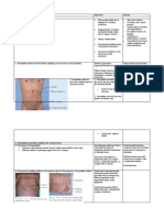 Abdominal Aortic Aneurysm