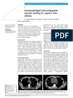 Nasser Et Al. - 2013 - Use of Transoesophageal Echocardiography in Endovascular Stenting For Superior Vena Cava Syndrome