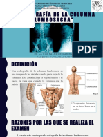 RX Columna Lumbosacra