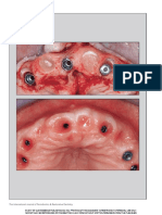 (IJPRD) GLUCKMAN 2017 - Partial Extraction Therapies Part 2 PDF