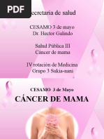 Cancer de Mama