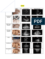 Efast: Name Position Normal US Pic Abnormal US Pic Subcostal