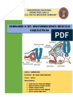 Embriologia: Malformaciones Musculoesqueléticas