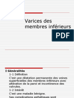 Varices Des Membres Inférieurs