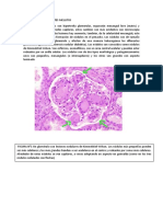 Histología de La Diabetes Mellitus