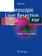 Laparoscopic Liver Resection