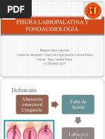 Fisura Labipalatina y Fonoaudiologia