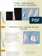 Conometría y Obturación en Pieza Dentaria Anterior