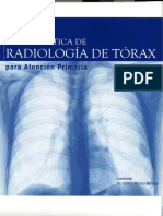 Guía Práctica Radiología Tórax I