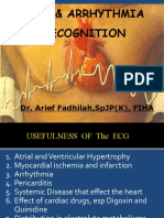 Ecg & Arrhythmia Recognition: Dr. Arief Fadhilah, SPJP (K), Fiha