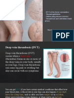 DVT of The Lower Extremities. - Thrombophlebitis. - Obliterating Disease Arteries. - Thrombosis and Embolism Trunk Artery