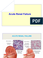 Acute Renal Failure