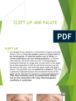 Cleft Lip and Palate